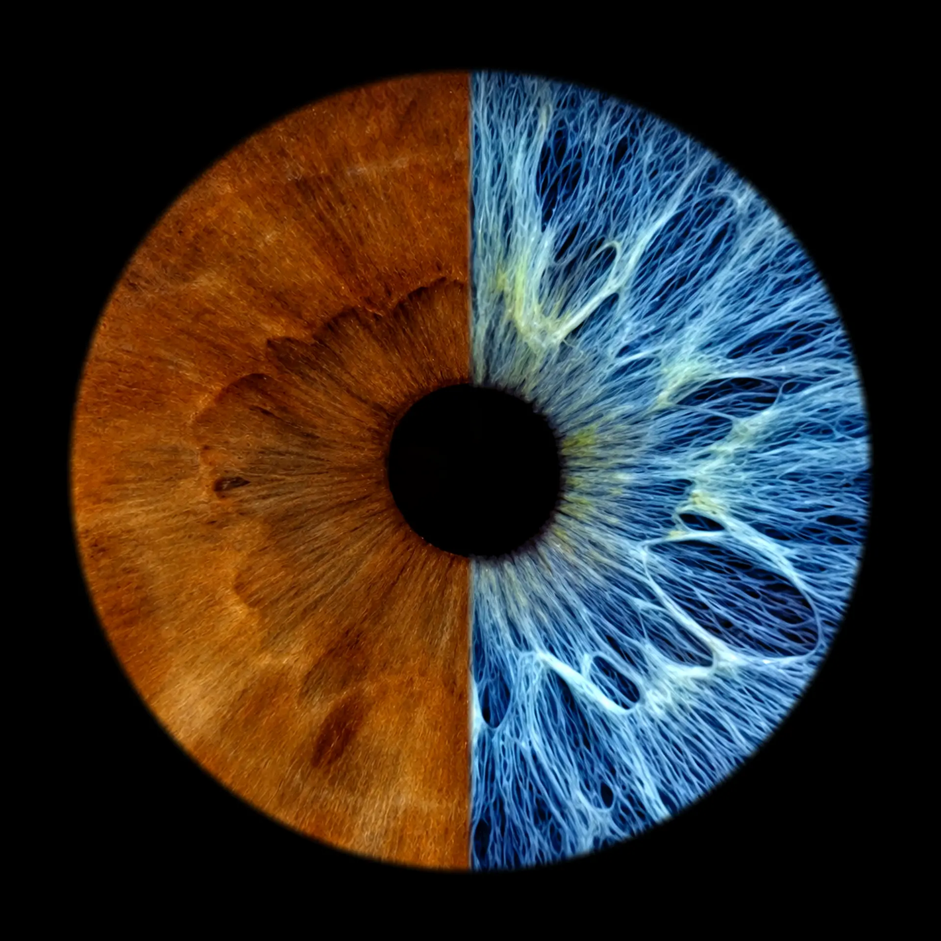 One iris, two halves — amber and blue iris artwork